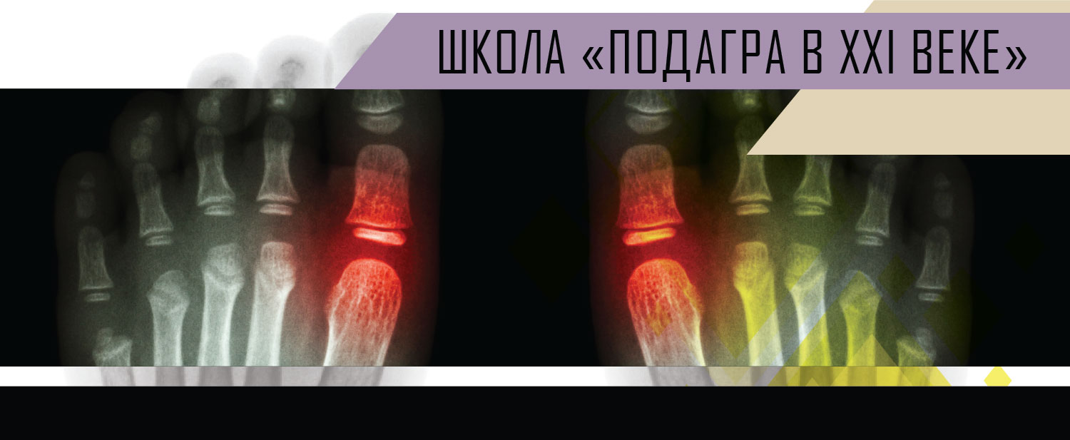 Школа «Подагра в XXI веке» — Medincon